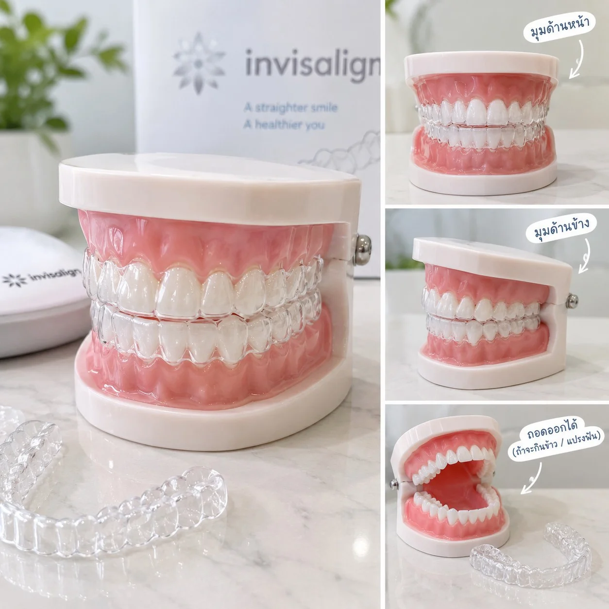 จัดฟันใส จัดฟันเหล็ก DC Dental